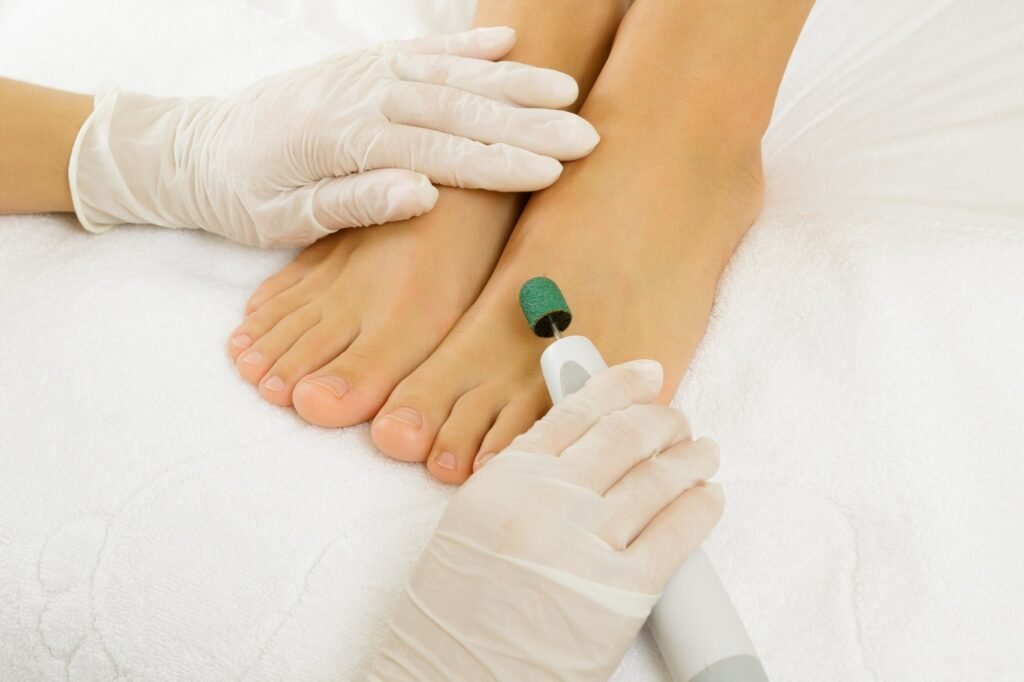 Callus treatment during pedicure